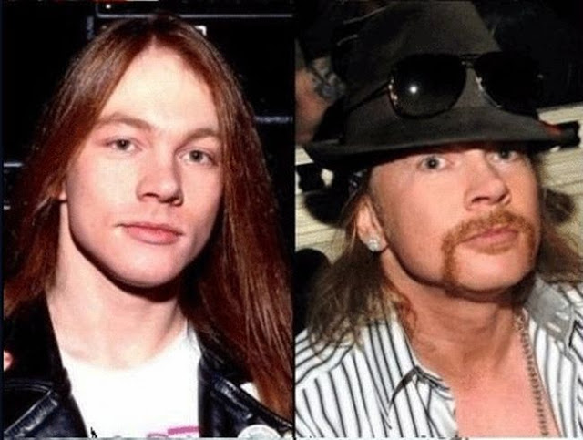 axel-rose-rock stars then and now