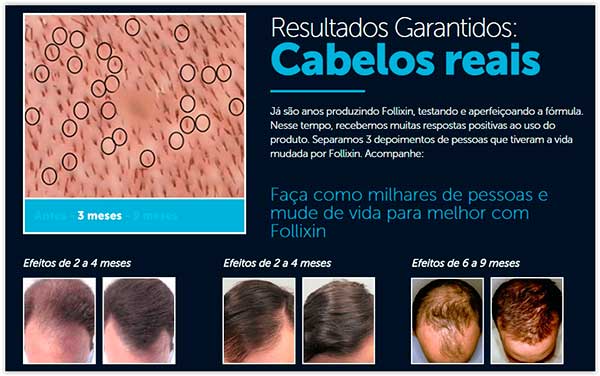 Follixin resultados antes e depois